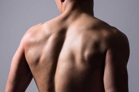 Mens_Hair_Removal_Back_Neck_and_Shoulders
