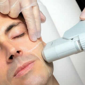 Skin Rejuvenation, Full Face for Him